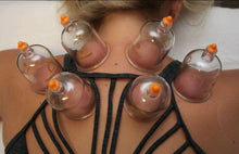ATLANTA, GA - MARCH 23-24 - Evidence Informed Clinical Cupping