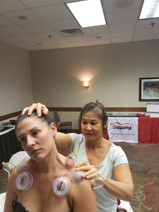 Live Online Evidence Informed Clinical Cupping - Levels 1-4