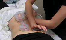 Live Online Evidence Informed Clinical Cupping - Levels 1-4