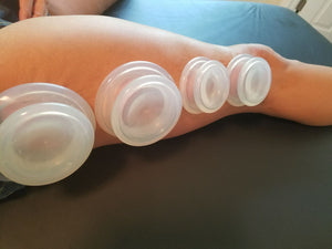 SYRACUSE, NY - July 8-9 - Evidence Informed Clinical Cupping
