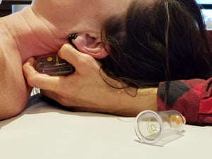 SYRACUSE, NY - July 8-9 - Evidence Informed Clinical Cupping