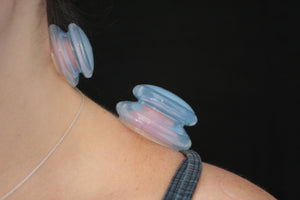 SYRACUSE, NY - July 8-9 - Evidence Informed Clinical Cupping