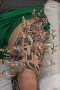 Live Online: Lower Body - Evidence Informed Clinical Cupping - Level 3