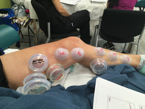 Live Online: Lower Body - Evidence Informed Clinical Cupping - Level 3