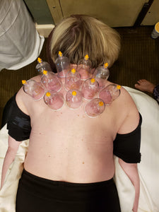 Live Online: Advanced: Cupping with Movement - Level 4