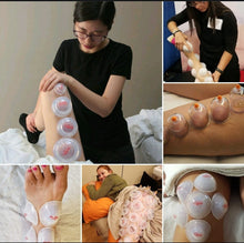 SYRACUSE, NY - July 8-9 - Evidence Informed Clinical Cupping