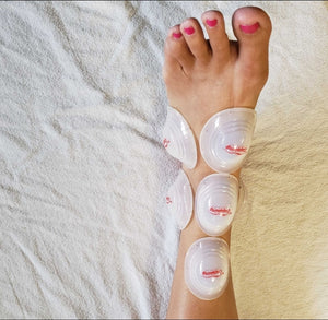 SYRACUSE, NY - July 8-9 - Evidence Informed Clinical Cupping